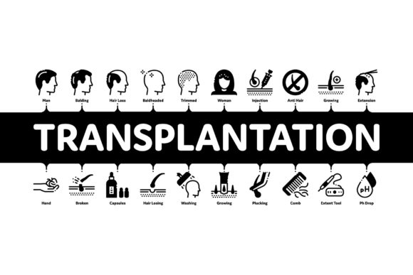 Evaluating the Hair Transplantation Minimal Infographic for Medical Communication
